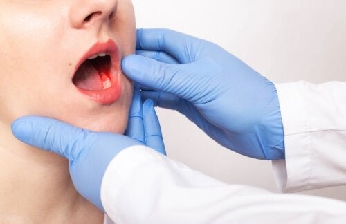 De symptomen en oorzaken van parodontitis