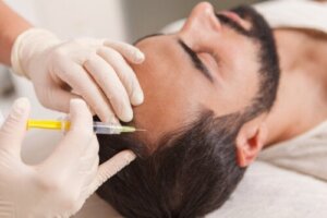 Wat is PRP tegen haaruitval of biostimulatie met bloedplaatjesrijk plasma?