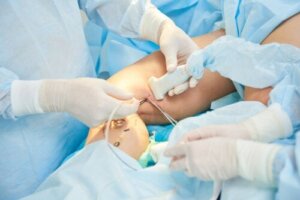 Sclerotherapie voor spataderen: hoe wordt het uitgevoerd?