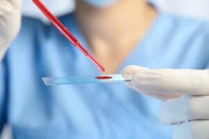 Chronische eosinofiele leukemie: symptomen, diagnose en behandeling