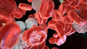 Polycythemia vera: oorzaken, symptomen, diagnose en behandeling