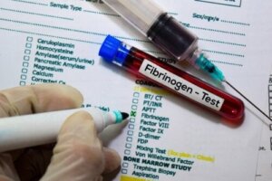 Bloedonderzoek voor fibrinogeen: functies en resultaten