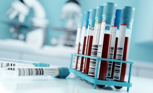 Wat is de GGT-test en wat betekenen de resultaten?