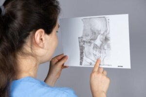 Wat is mandibulaire retrognathie en hoe wordt het behandeld?